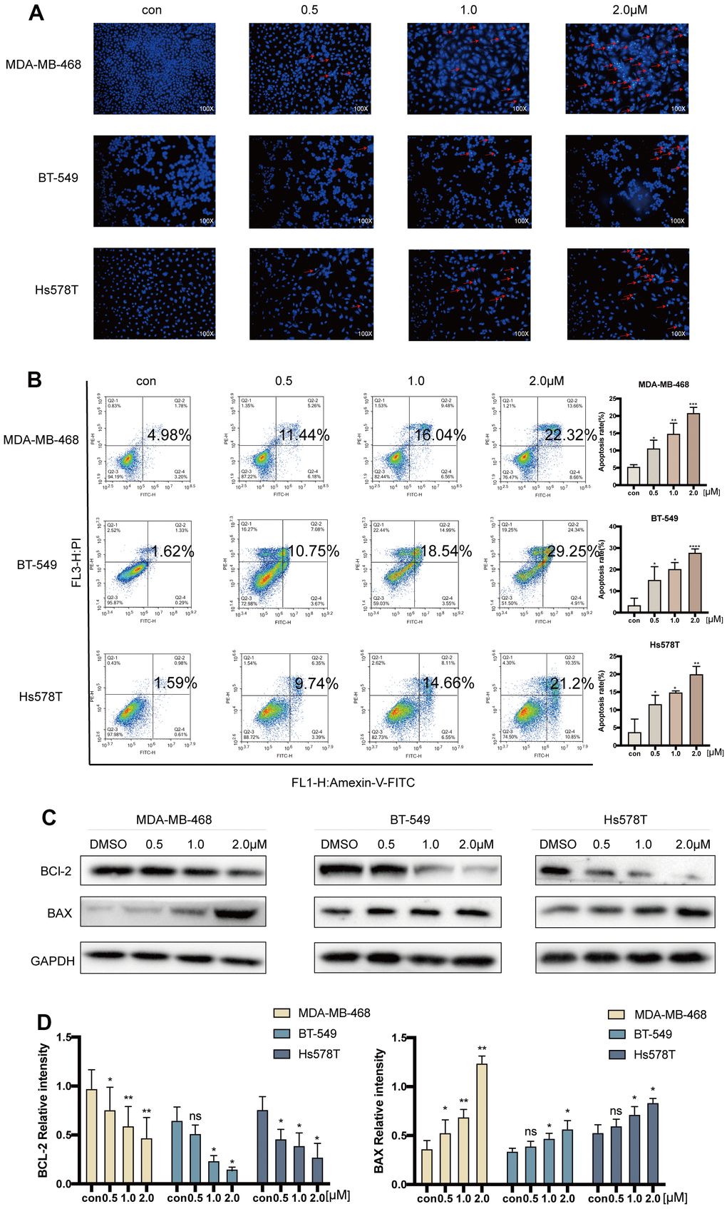 Acetyl-cinobufagin induced cell apoptosis in TNBC cells. (A) Hoechst 33342 staining and (B) flow cytometric analysis were performed to study the cell apoptosis rate after treatment with 0, 0.5, 1.0, and 2.0 μM of acetyl-cinobufagin for 24 h in MDA-MB-468, BT-549 and Hs578T cells by Annexin V and PI. (C, D) The expression levels of BAX and BCL-2 in above-mentioned three TNBC cell lines were determined by immunoblotting after treatment with acetyl-cinobufagin at three concentrations for 24 h. *p p p p 