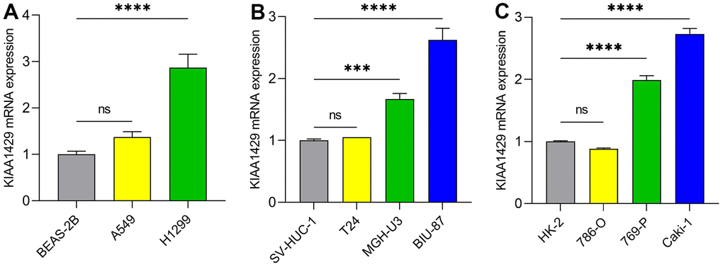 The mRNA expression levels of KIAA1429 in different cell lines. (A) LUAD cell lines, (B) BLCA cell lines, (C) KIRC cell lines. ***P P 