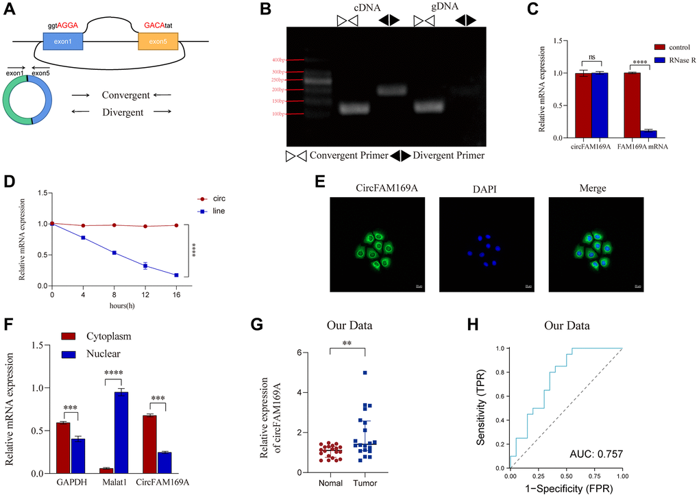 Characteristics of circFAM169A in CRC cells. (A) The diagram represents the structure of circFAM169A and the arrows denote the different primers. (B) The reverse transcription–PCR (RT-PCR) products from different primers were detected by agarose gel electrophoresis. (C) Samples were treated with RNase (+) or buffer (−), and the expression of circFAM169A was determined by quantitative RT–PCR (qRT–PCR). (D) SW480 cells were treated with (+) or without (−) actinomycin D, and the stability of circFAM169A was assessed by qRT–PCR. (E) Cells were analyzed by immunofluorescence cytochemistry. Scale bar = 20 μm. (F) The location of circFAM169A, GAPDH, and Malat1 in CRC cells. (G) Relative expression of circFAM169A in 20 paired CRC tumor and adjacent normal tissues determined using qRT–PCR. (H) ROC curves illustrating the capacity of circFAM169A to distinguish between tumors and adjacent tissues from patients with CRC. All data are presented as means ± standard deviation (SD) (n = 3 independent experiments). *p ≤ 0.05, **p ≤ 0.01, ***p ≤ 0.001, and ****p ≤ 0.0001.