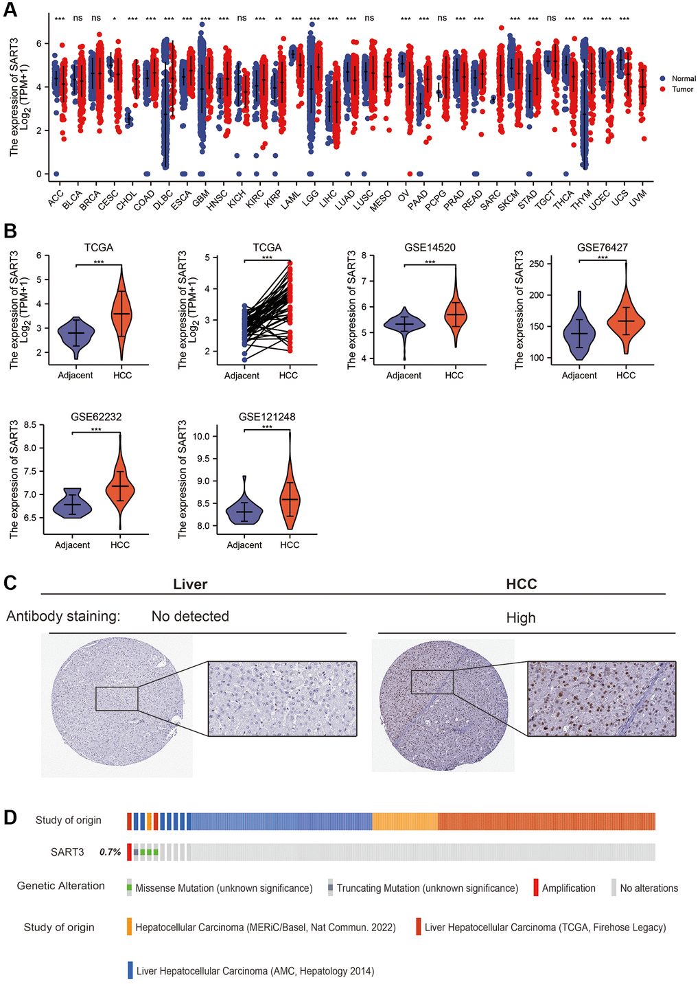 SART3 is highly expressed in the HCC transcriptome and proteome. (A) SART3 expression levels in 31 different human cancers. Panels (B) present the expression levels of SART3 in various datasets, including TCGA LIHC dataset, GSE14520 dataset, GSE76427 dataset, GSE62232 dataset, and GSE121248 dataset. (C) Validation of SART3 expression levels in the HCC proteome in the Human Protein Atlas database. (D) Distribution of genomic changes of SART3 in cBioPortal OncoPrint plots. ns. p ≥ 0.05; *p  0.05; **p  0.01; ***p  0.001.