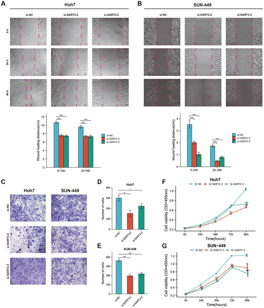 Representative images and corresponding histograms of the wound healing assay of Huh-7. (A) and SUN-449 (B) cells in si-SART3 group and control group. Representative images (C) and corresponding histograms (D, E) of the Trans-well assay of Huh-7 and SUN-449 cells in si-SART3 group and control group. Growth curves of Huh-7 (F) and SUN-449 (G) cells in si-SART3 group and control group by CCK-8 assay.