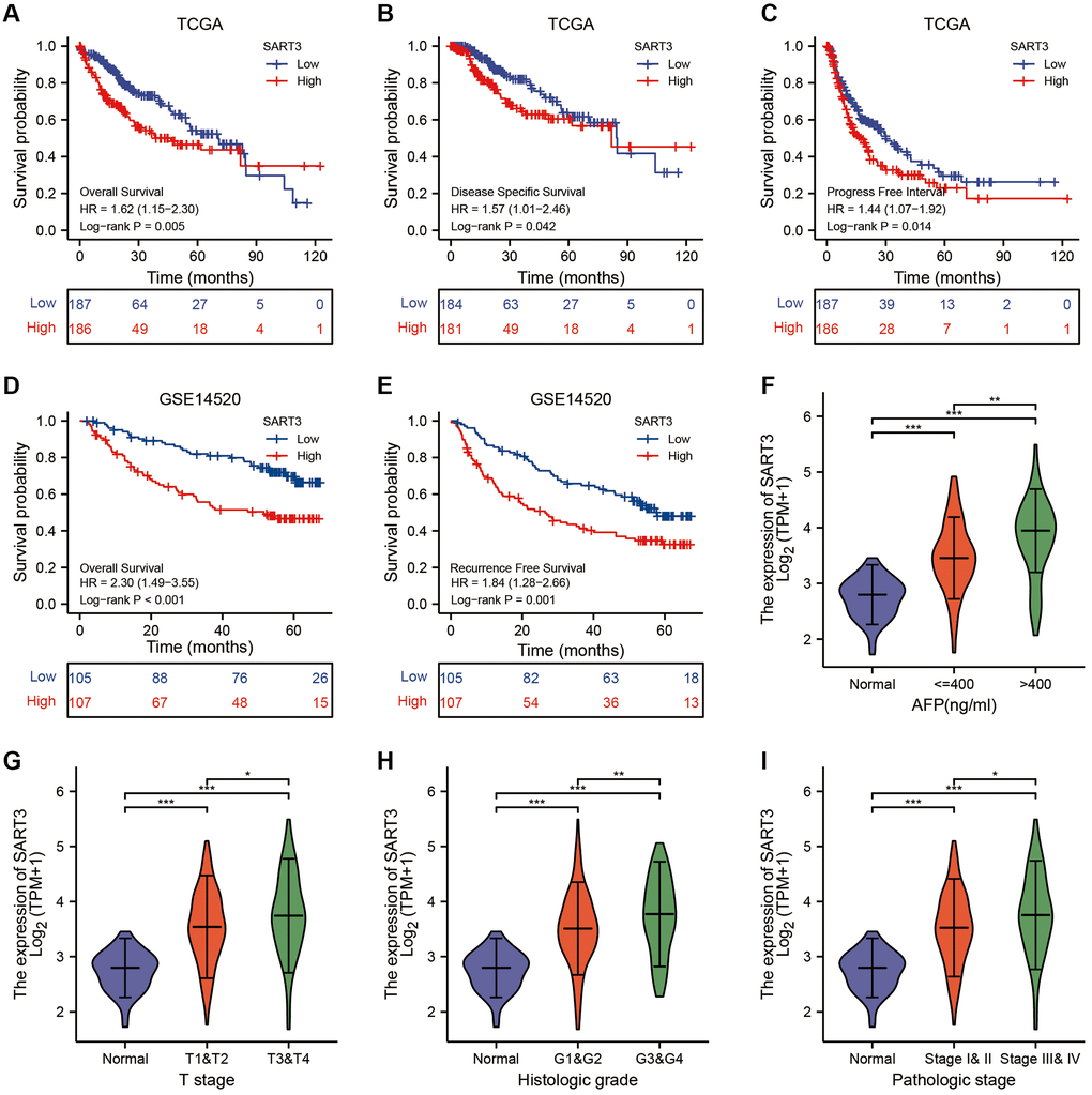 High expression of SART3 correlates with poor prognosis and advanced staging of HCC. Kaplan-Meier curves show SART3high and SART3low groups for (A) OS, (B) DSS and (C) PFS in TCGA dataset, and for (D) OS and (E) RFS in GSE14520 dataset. Violin plot shows SART3 expression at different AFP levels (F), T-stage (G), histological grade (H) and pathological stage (I) expression levels, *p  0.05; **p  0.01; ***p  0.001.