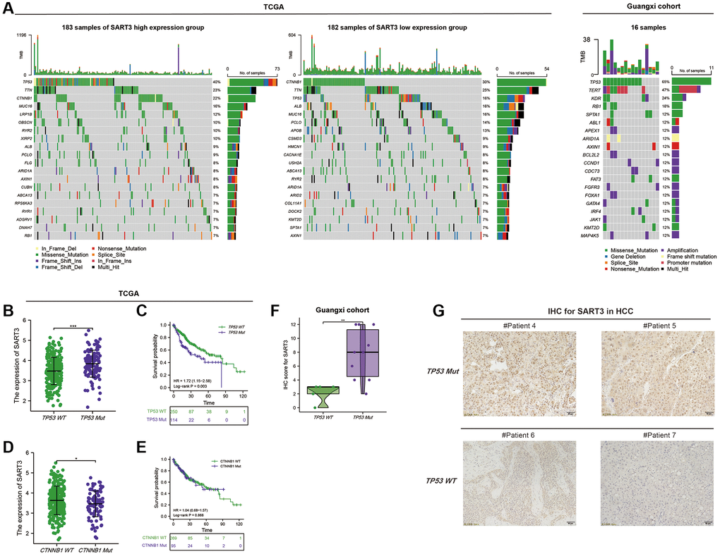 Somatic mutation landscape of HCC based on SART3. (A) Waterfall plots demonstrate the HCC somatic mutation landscape in the SART3high and SART3low in TCGA and Guangxi cohort. In the TCGA cohort, (B) SART3 expression between TP53 mutation and TP53 wild group, (C) survival analysis of TP53 mutation group and TP53 wild group, (D) SART3 expression between CTNNB1 mutation and wild group, (E) survival analysis of CTNNB1 mutation group and CTNNB1 wild group. (F) Immunohistochemical staining intensity of SART3 between TP53 mutation and TP53 wild group in the Guangxi cohort. (G) Representative images of immunohistochemistry.