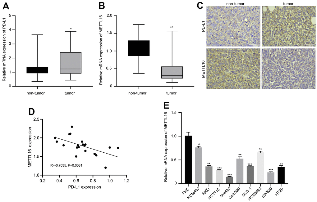 Expression of METTL16 and PD-L1 in clinical samples and cell lines of CRC. CRC tumor and non-tumor tissues were collected from patient with CRC. The RNA levels of (A) PD-L1 and (B) METTL16 were measured by qPCR assay. (C) The protein expression of PD-L1 and METTL16 was measured by IHC experiment. (D) The Pearson correlation analysis of PD-L1 and METTL16 in tumor tissues (n=20). (E) The RNA level of METTl16 in CRC cell lines (NCM460, RKO, HCT116, SW480, Colo320, DLD-1, HCE8693, SW620, and HT29) and normal human colon epithelial cell line FHC was measured by qPCR. *p