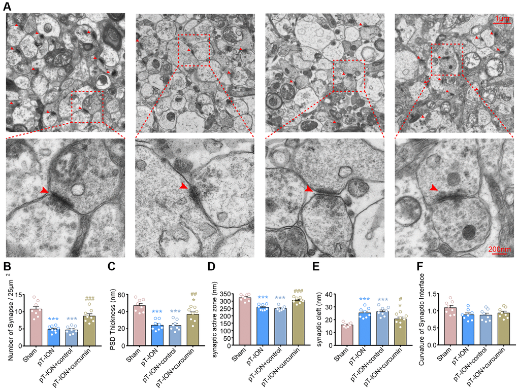 The protective effects of curcumin on the density and ultrastructure of synapses of hippocampal CA1 region in pT-ION mice. (A) Representative TEM images showing the density and ultrastructure of synapses of hippocampal CA1 region in each group (scale bar: 1 μm and 200 nm). Bar graphs showing the number of synapses/25 μm2 (B), the thickness of the PSD (C), the length of the synaptic active zone (D), the width of the synaptic cleft (E), and the curvature of the synaptic interface (F) in each group. N = 8 mice/group. *P ***P #P ##P ###P 