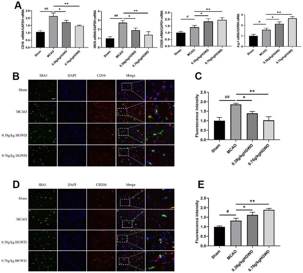 HGWD promotes the M2 phenotype in microglia after ischemic stroke. (A) M1 marker (CD16 and iNOS) mRNA and M2 marker (CD206 and Arg-1) mRNA levels. (B) Representative double-immunofluorescence staining for CD16 (red) and Iba-1 (green) markers in hippocampus. (C) Quantification of the fluorescence intensity of CD16+/Iba-1+ cells. (D) Representative double-immunofluorescence staining for CD206 (red) and Iba-1 (green) markers in hippocampus. (E) Quantification of fluorescence intensity of CD206+/Iba-1+ cells. Scale bar: 50 μm. #P##P PP