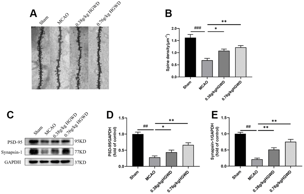 HGWD promoted dendritic spine density and synaptic plasticity. (A) Examples of dendritic spines. Scale bar=10 μm. (B) Density of dendritic spines. (C) Representative western blot bands of PSD95 and synapsin I in each group. (D, E) The quantitative analysis of PSD95 and synapsin I expression in hippocampus. ##P PP