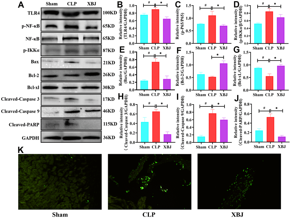 Effects of XBJ on apoptosis-related proteins and TLR4/NF-κB/IKKα signaling pathway. (A) Representative images of western blotting for TLR4, p-NF-κB, NF-κB, p-IKKα, Bax, Bcl-2, Bcl-xl, Cleaved-Caspase 3, Cleaved-Caspase 9 and Cleaved-PARP in vivo (GAPDH was used as the internal reference protein). (B–J) Relative intensity of TLR4 (B), p-NF-κB/NF-κB (C), p-IKKα (D), Bax (E), Bcl-2 (F), Bcl-xl (G), Cleaved-Caspase 3 (H), Cleaved-Caspase 9 (I) and Cleaved-PARP (J) was analyzed by western blotting. Data are expressed as mean ± SD (n=3/group), # indicates ppK) Representative images show apoptosis of heart tissue was detected with TUNEL staining.