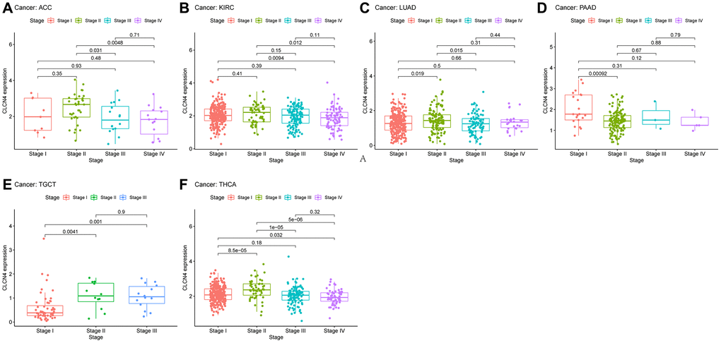 The association between CLCN4 expression and cancer pathological grades (stage I, II, III, IV). (A) ACC. (B) KIRC. (C) LUAD. (D) PAAD. (E) TGCT. (F) THCA.