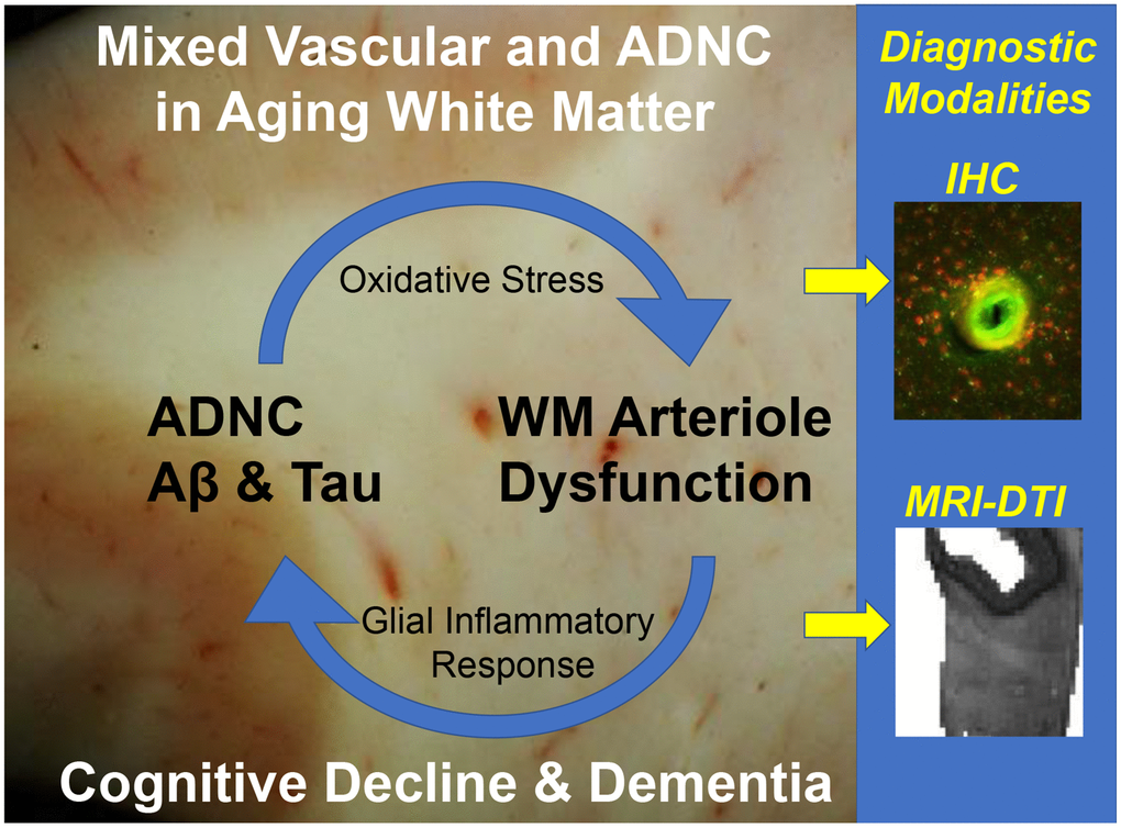 A vicious cycle generating WM injury driven by mixed vascular and ADNC in the aging human white matter. Diagnostic challenges for IHC and neuroimaging.