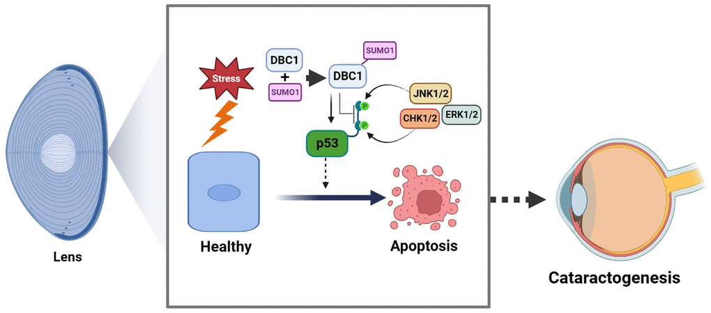 Model for the role of DBC1 in p53-dependent stress-induced apoptosis. DBC1 can be SUMOylated at K591 by SUMO1 conjugation in lens epithelial cells. Upon oxidative stress, DBC1 inhibits p53 phosphorylation (derived from upstream kinases such as CHK1/2, JNK1/2 and ERK1/2 depending on the stimuli) to modulate p53 functional status. DBC1 SUMOylation enhances p53-depedent oxidative stress-induced apoptosis, which eventually causes cataractogenesis.