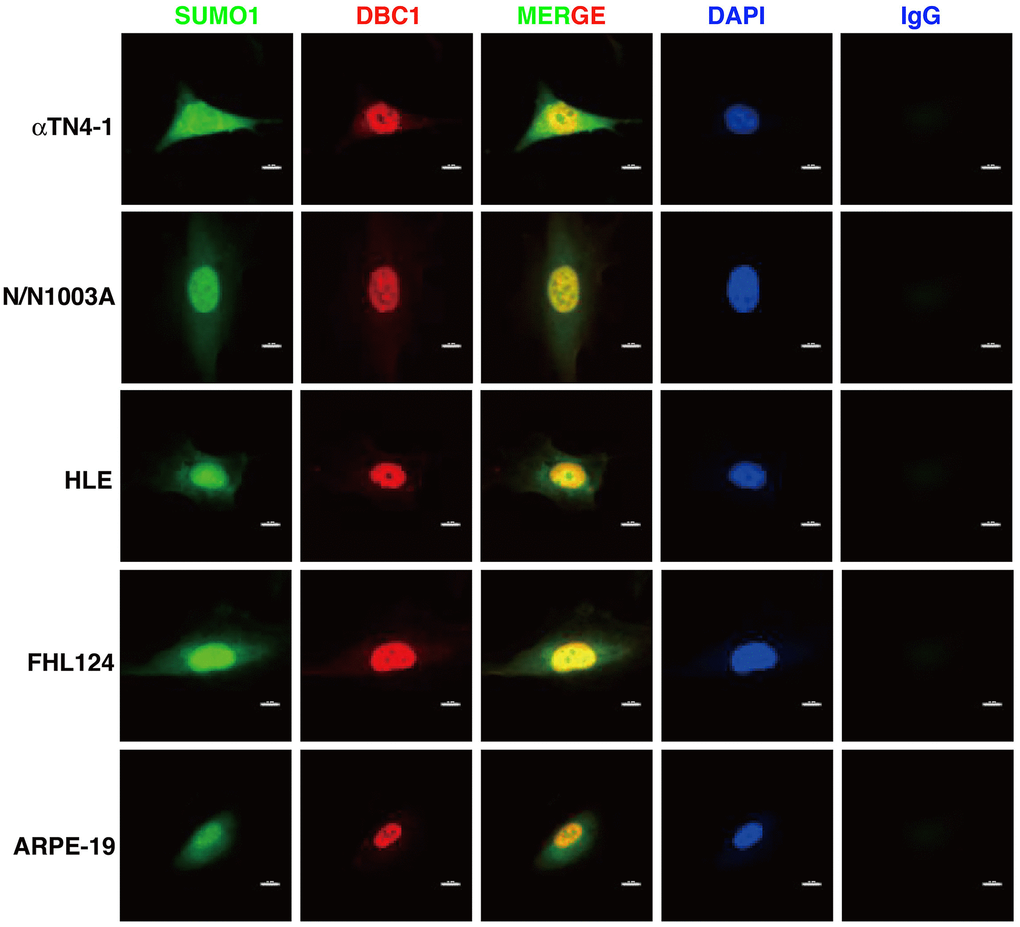 Immunofluorescence analysis of DBC1 in the five ocular cell lines. Note that DBC1 (red) was located in the nuclei (DAPI staining, blue), while SUMO1 (green) was located in the nuclei and cytoplasm, co-localized with DBC1 in the nuclei. IgG served as a negative control. Scale bar, 12 μm.