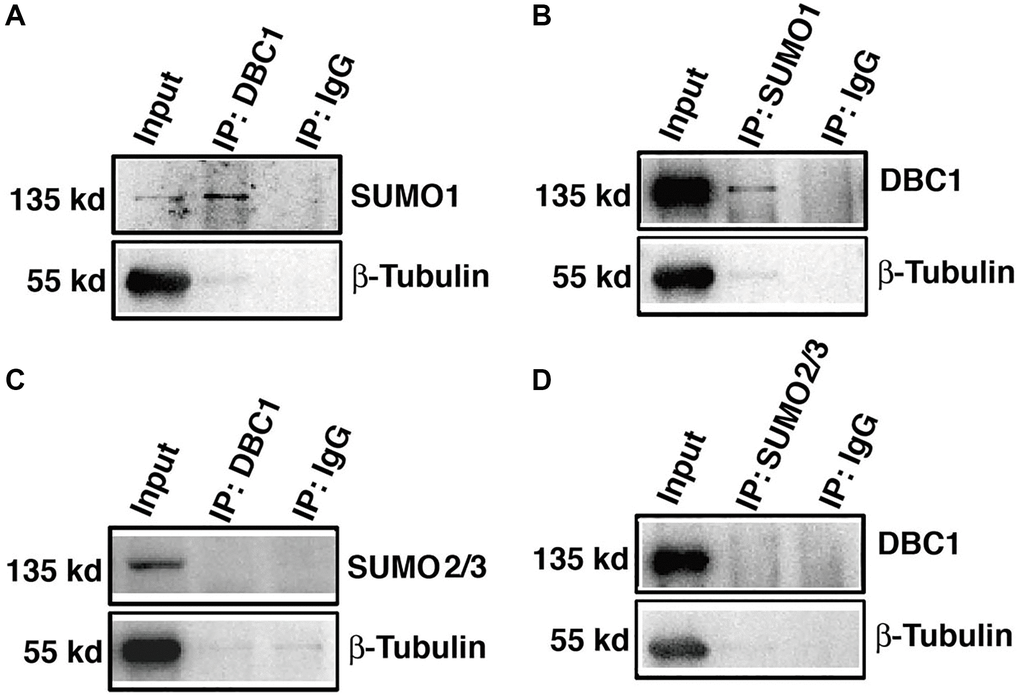 DBC1 is modified by SUMO1 rather than by SUMO2/3 in mouse lens. (A, B) The cell lysates of wildtype mouse lens epithelium were immunoprecipitated (IP) with anti-DBC1 (A) or anti-SUMO1 (B) antibody, followed by immunoblotting with anti-SUMO1 (A) or anti-DBC1 (B) antibody. (C, D) The cell lysates of wildtype mouse lens epithelium were immunoprecipitated (IP) with anti-DBC1 (C) or anti-SUMO2/3 (D) antibody, followed by immunoblotting with anti-SUMO2/3 (C) or anti-DBC1 (D) antibody.