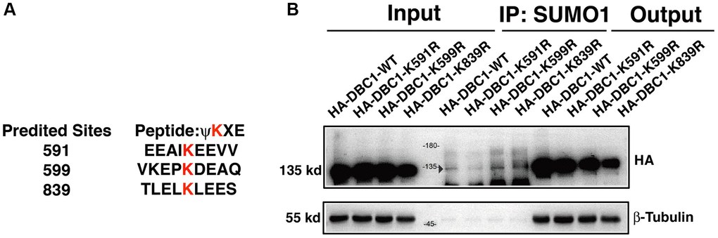 DBC1 is modified by SUMO1 at K591 in human lens epithelial cells. (A) Three putative lysine residues for SUMOylation of DBC1 were shown in red bold. (B) FHL124 cells were transfected with HA-tagged wildtype DBC1 (DBC1-WT) or its K-to-R mutants (K591R, K599R, K839R) as indicated. 24 hours after transfection, cell lysates were immunoprecipitated (IP) with anti-SUMO1 antibody and immunoblottings were performed with anti-HA. β-tubulin was used as a reference for loading.
