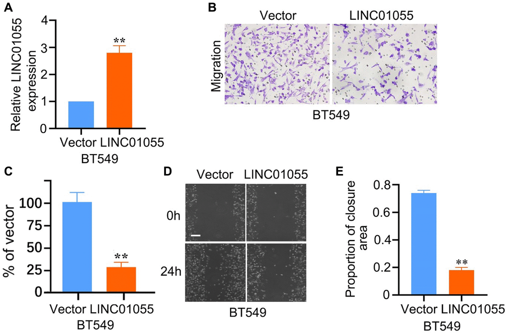 Effects of overexpression of LINC01055 on migration and invasion ability of BRCA cells. (A) Relative expression of LINC01055 detected by qRT-PCR in BT549 cells (n = 3). (B, C) Transwell analysis detected the effect of overexpressed LINC01055 on the invasion ability of BT549 (n = 3) (×100). (D, E) Scratch assay detected the migration ability of BT549 by 0 and 24 hours (n = 3) (×40).
