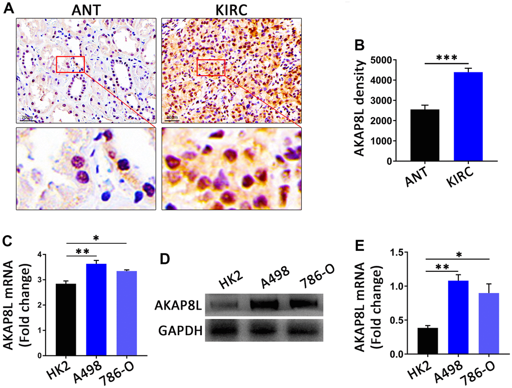 The AKAP8L expression in KIRC. (A) Representative images showing immunohistochemica (IHC) staining results of AKAP8L in KIRC tissues (KIRC) and adjacent normal tissues (ANT) (scale bar, 20 μm). (B) Semiquantitative analysis of IHC staining (n=10). (C) The mRNA expression levels of AKAP8L in different cell types (n≥3). (D) Protein expression levels of AKAP8L and GAPDH in different cell types. (E) Semi-quantification of AKAP8L protein expression level determined by densitometry normalized to GAPDH. *P**P***P