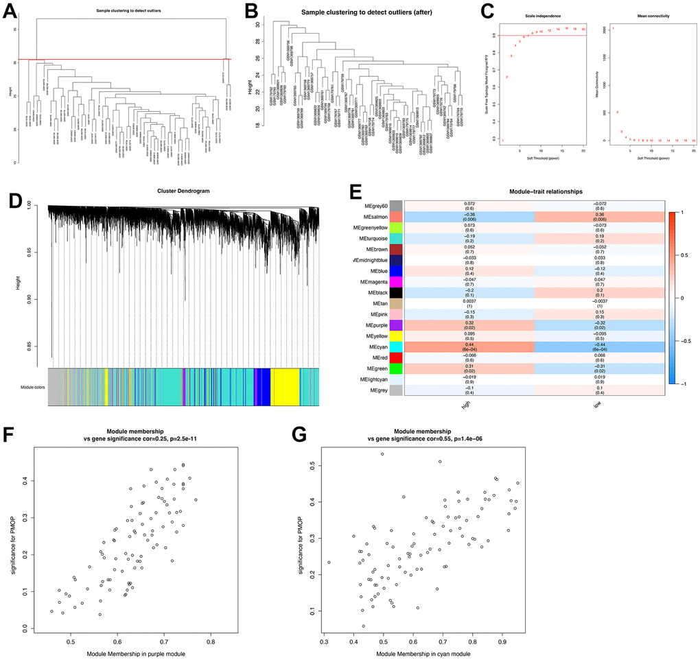 Construction of WGCNA co-expression network. (A) Sample clustering dendrogram and the samples whose height > 31 were identified as outliers. (B) Sample clustering dendrogram after cutting the outliers. (C) Soft threshold b = 7 and scale-free topological fit index (R2). (D) Shows the modules with different colors under the clustering tree. (E) Heat map of module-trait correlations. (F) MM vs. GS scatter plot of the purple module. (G) MM vs. GS scatter plot of the cyan module. Red represents positive correlations and blue represents negative correlations.