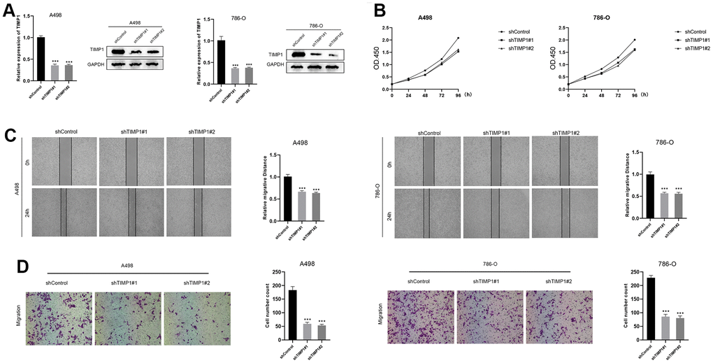 Down-regulation of TIMP1 suppressed the progression of ccRCC in vitro. (A) The expression of TIMP1 in A498 and 786-O cells was detected by RT-qPCR and Western blot; (B) TIMP1-knockdown suppressed ccRCC cell proliferation in A498 and 786-O cells; (C) Wound-healing tests demonstrated changes in ccRCC cell migration; (D) TIMP1-knockdown suppressed ccRCC cell metastasis in A498 and 786-O cells.