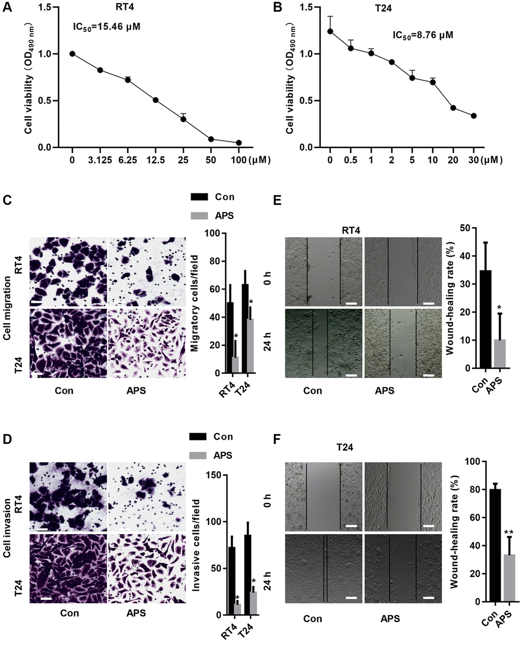 APS inhibits the proliferation and migration of RT4 and T24 cells. CCK-8 assays revealed that APS significantly inhibited the viability of RT4 (A) and T24 (B) cells. The transwell results revealed that 15 and 10 μM APS significantly inhibited the migration of RT4 (C) and T24 (D) cells (Bar represents 10 μm, 20 × magnification). Scratch assays confirmed that 15 and 10 μM APS significantly reduced the migration of RT4 (E) and T24 (F) cells (Bar represents 50 μm, 4 × magnification). *p **p 