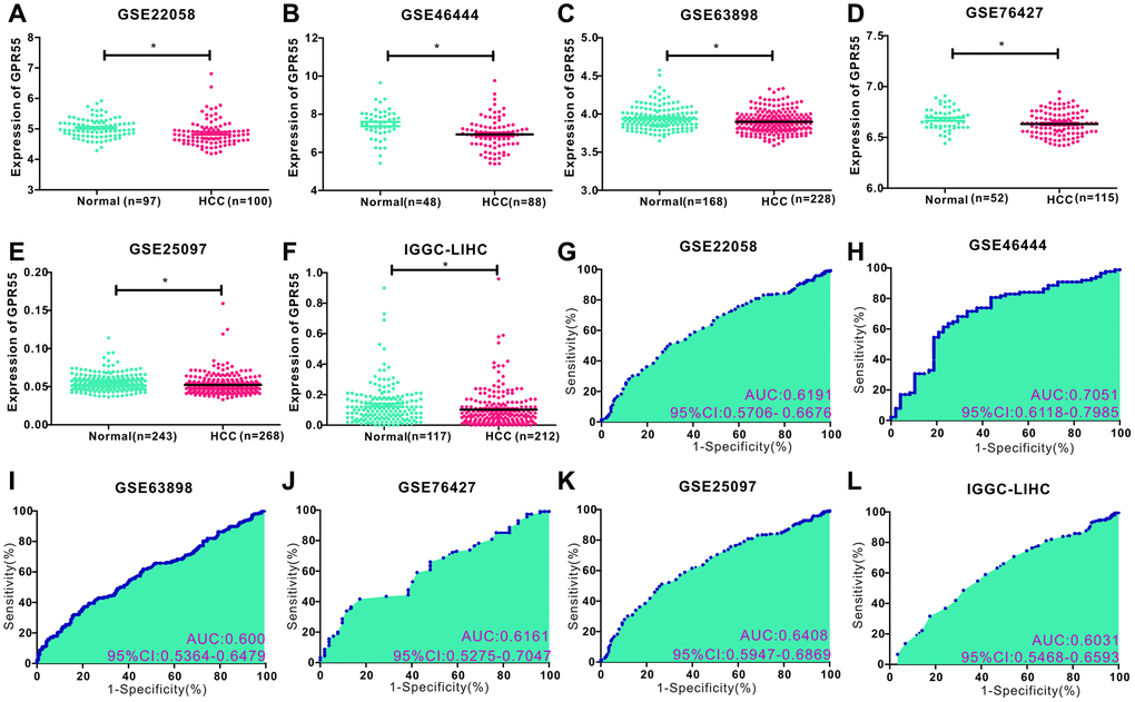 (A–F) Comparison of GPR55 expression in normal and tumor tissues in different HCC data sets (GSE22058, GSE46444, GSE63898, GSE76427, GSE25097, IGGC-LIHC) (*P G–L) ROC diagnostic curve of GPR55 in different data sets.