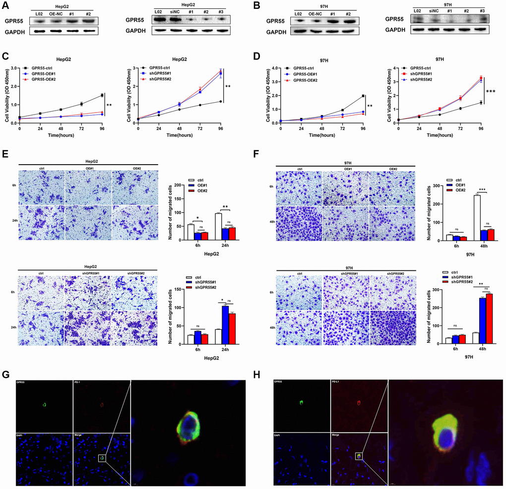 (A) Protein levels of GPR55 were detected by western-blotting in HepG2 cells, respectively. (B) Protein levels of GPR55 were detected by western-blotting in 97H cells, respectively. (C) Determination of cell viability in HepG2 cells. (D) Determination of cell viability in 97H cells. (E) Transwell assay in HepG2 cells. (F) Transwell assay in 97H cells. (G) Immunofluorescence staining of GPR55 and PD-1. (H) Immunofluorescence staining of GPR55 and PD-L1. N = 3, ***P t-test.