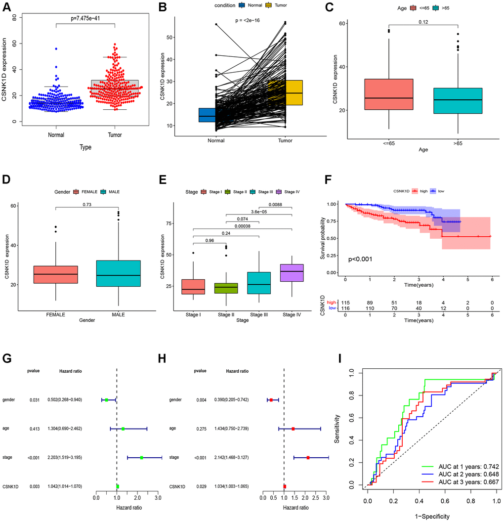 Validation of CSNK1D expression in hepatocellular carcinoma based on the ICGC-LIRI-JP cohort. (A) The mRNA expression of CSNK1D in normal and tumor. (B) Comparing the CSNK1D expression in paired normal and tumor. Variation analysis of CSNK1D expression in different Ages (C), Gender (D), stage (E). (F) K-M survival curves of patients with OS. (G, H) The prognostic significance of CSNK1D was analyzed by univariate and multivariate COX analysis. (I) Prognostic evaluation efficacy of CSNK1D by ROC.