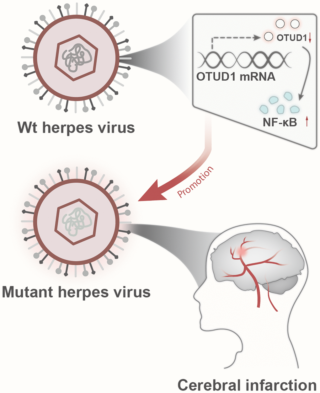 Schematic diagram of the molecular mechanism by which herpesvirus latency activates the OTUD1/NF-κB signaling pathway to promote stroke occurrence.