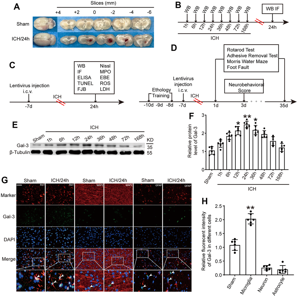 The protein level of Gal-3 in microglia increased significantly at 24 h after ICH. (A) Brain tissue sections of rats in sham group and intracerebral hemorrhage group. (B) Experiment 1: the time course changes of Gal-3 after ICH. (C, D) Experiment 2: the role of Gal-3 in ICH - induced brain injury. (E, F) Western blot analysis and quantification of Gal-3 at 1h, 6h, 12h, 24h, 36h, 48h, 72h, and 168h after ICH. (G, H) Double immunofluorescence analysis of Gal-3(green) and different brain cells (red) in brain sections. microglial marker (Iba-1)/Neuron marker (MAP2)/ Astrocyte marker (GFAP). Nuclei were labeled with DAPI (blue). Arrow indicated Gal-3 positive cells. Scale bar =50 μm. The black dots represent individual data in each group. **p p 