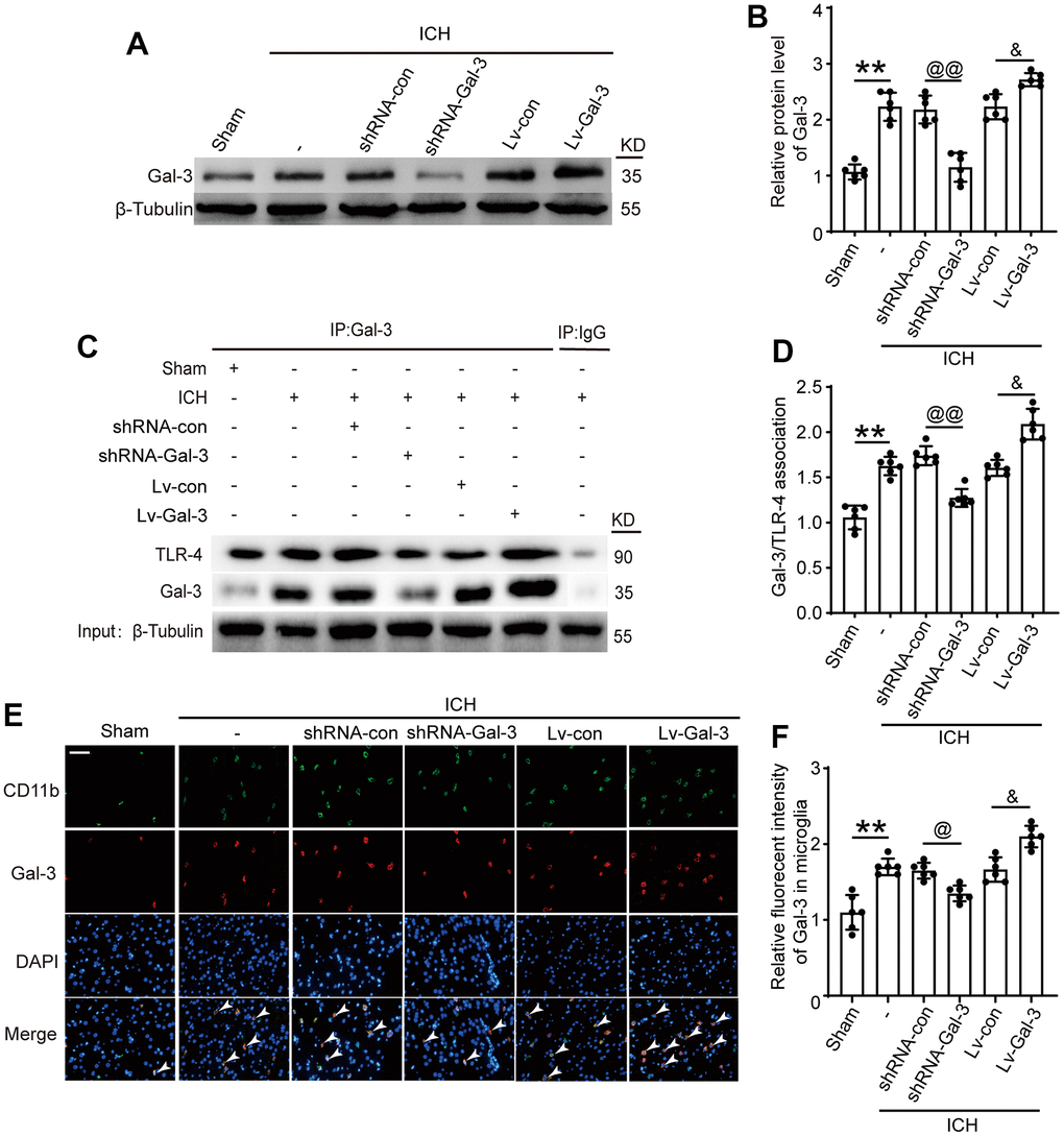 Intervention efficiency of overexpression and small interfering RNA lentivirus on Gal-3. (A, B) Western blot analysis and quantification of Gal-3 in intervention groups. (C, D) Gal-3/TLR-4 interactions in brain tissues after ICH and quantitative analysis was performed. (E, F) Double immunofluorescence analysis of Gal-3 (green) and microglia (red) in brain and the relative fluorescent intensity of Gal-3 in microglia, arrow indicated Gal-3 positive cells. Nuclei were labeled with DAPI (blue). Scale bar =50 μm. The black dots represent individual data in each group. **p p @@p @p &p 