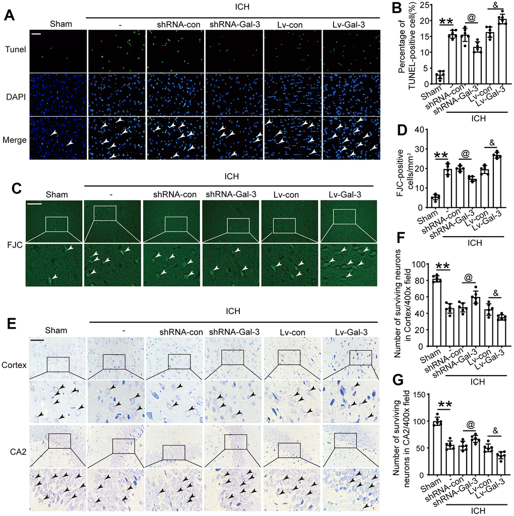 Inhibition of Gal-3 reduced apoptosis and neuron loss induced by ICH. (A, B) Apoptotic cells were labeled in brain sections using TUNEL staining, and the percentage of apoptotic cells was analyzed statistically. Arrow indicated TUNEL positive cells. Nuclei were labeled with DAPI (blue). (C, D) FJC staining. Arrow indicated FJC positive cells. (E–G) Nissl staining was used to assess the loss of neurons in the CA2 region of the hippocampus and in the cortex. Arrow indicated surviving cells. Scale bar = 50um. The black dots represent individual data in each group. **p p @p &p 