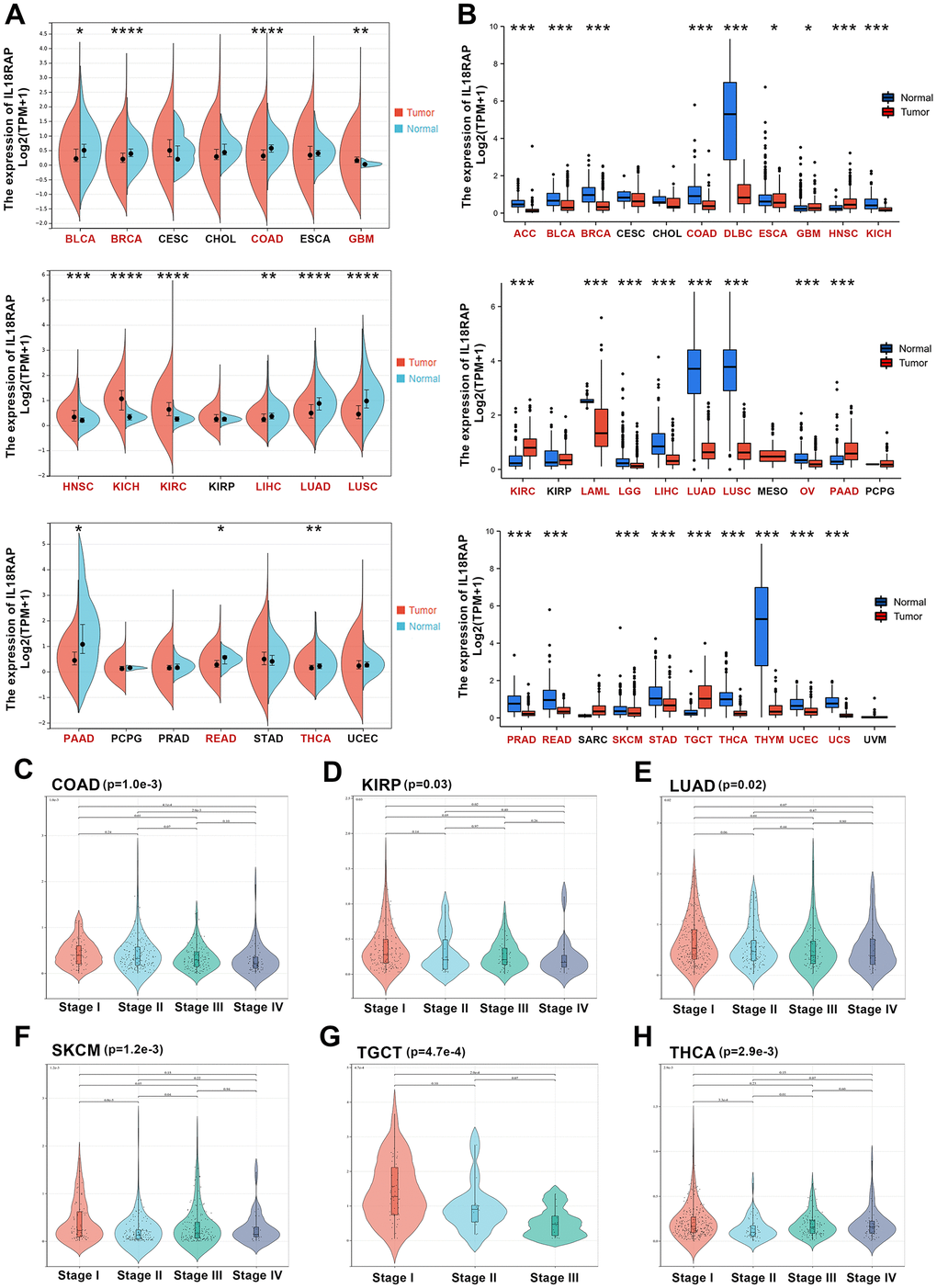 Differential expression analysis of IL18RAP. (A) The mRNA expression of IL18RAP in pan-cancer. (B) The mRNA expression of IL18RAP was examined across cancers and the corresponding normal tissues using the TCGA and GTEx databases. (C–H) The relationship between IL18RAP expression level and pathological stages of COAD (C), KIRP (D), LUAD (E), SKCM (F), TGCT (G), and THCA (H). *p 