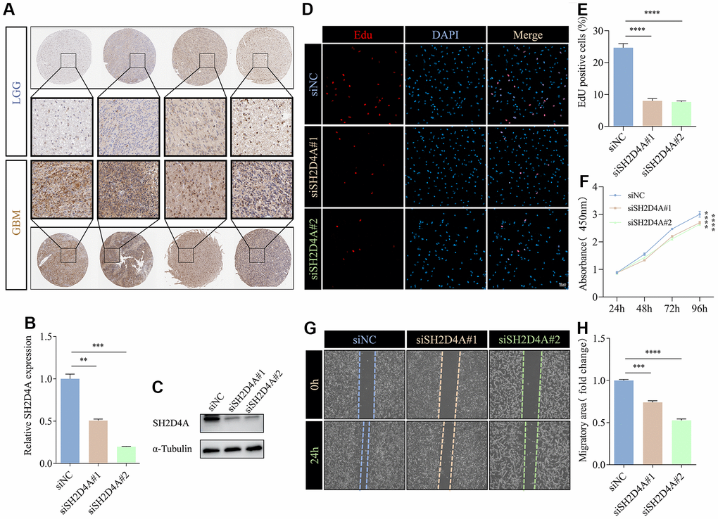 SH2D4A affects proliferation and migration of glioma cells. (A) Immunohistochemical staining of SH2D4A in glioma (data from HPA). (B, C) qRT-PCR and western blot analysis of SH2D4A knockdown efficiency in U87 MG cells. (D) Analysis of proliferation of control and SH2D4A-deficient U87 MG cells by CCK8 assay. (E, F) Representative images and statistical analysis of EdU assay in control and SH2D4A-deficient U87 MG cells. (G, H) Representative images and statistical analysis of cell migration assay in control and SH2D4A-deficient U87 MG cells at the indicated times. **, P 