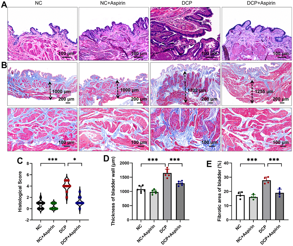 The effect of aspirin on bladder injury in STZ-induced diabetic rats after 10 weeks administration. (A) H&E-stained micrographs of histological features of rat bladder sections. (B) Masson-stained micrographs. The dotted arrowheads indicate the thickness of the bladder wall. (C) Histological score based on inflammation. (D) Statistical analysis of the thickness of bladder wall. (E) Morphological evaluation was performed with measurement of bladder fibrosis and collagen content. Data were presented as mean ± SD. N=6. (***, P 