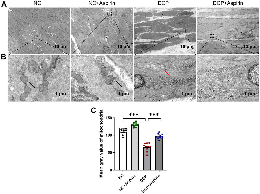 Transmission electron microscopy (TEM) of bladder DSM tissue after 10 weeks of aspirin administration. Organelles such as nucleus, mitochondria, and rough endoplasmic reticulum are seen. (A) A representative image from the bladder DSM at a magnification of ×1,000. (B) A representative image from the bladder DSM at a magnification of ×15,000. The red arrowheads indicate the swollen mitochondria. (C) Statistical analysis of the mitochondrial matrix optical density. Data were presented as mean ± SD. N=6. (***, P 