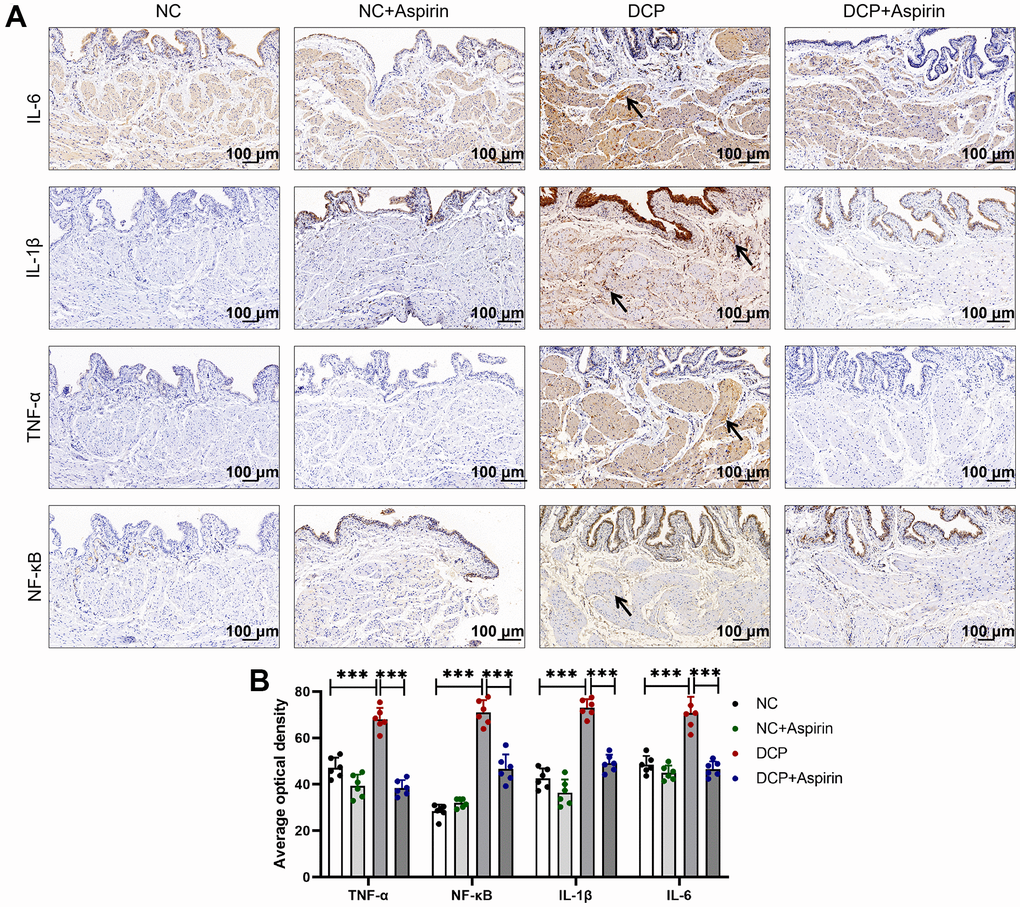 Immunohistochemistry shows aspirin suppress DSM tissue inflammation in diabetic rats after 10 weeks administration. (A) Immunohistochemistry indicates the expression of inflammatory mediators IL-6, IL-1β, TNF-α, and NF-κB was mainly distributed in the mucosa, lamina propria and meanwhile detrusor muscle. Arrows indicate positive staining (brownish-yellow). (B) The average optical density of IL-6, IL-1β, TNF-α, and NF-κB were analyzed using Image J Analysis System. Data were presented as mean±SD. N=6. (***, P 