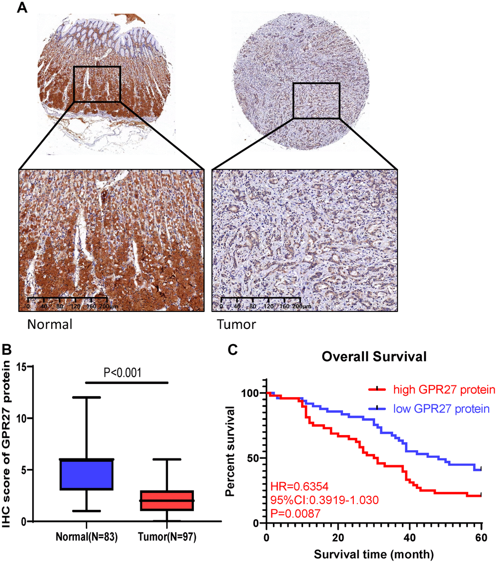 GPR27 is downregulated in gastric cancer clinical samples and correlated with longer survival in gastric cancer patients. (A) Immunohistochemical staining of normal and gastric cancer tissues with anti-GPR27 antibody. (B) Quantitative analysis of GPR27 staining shows significantly H-score in gastric tumor samples compared with adjacent normal tissues (83 normal tissues and 97 tumor samples). (C) Gastric cancer patients with GPR27 over-expression displayed less favorable overall survival than those with low GPR27 expression.