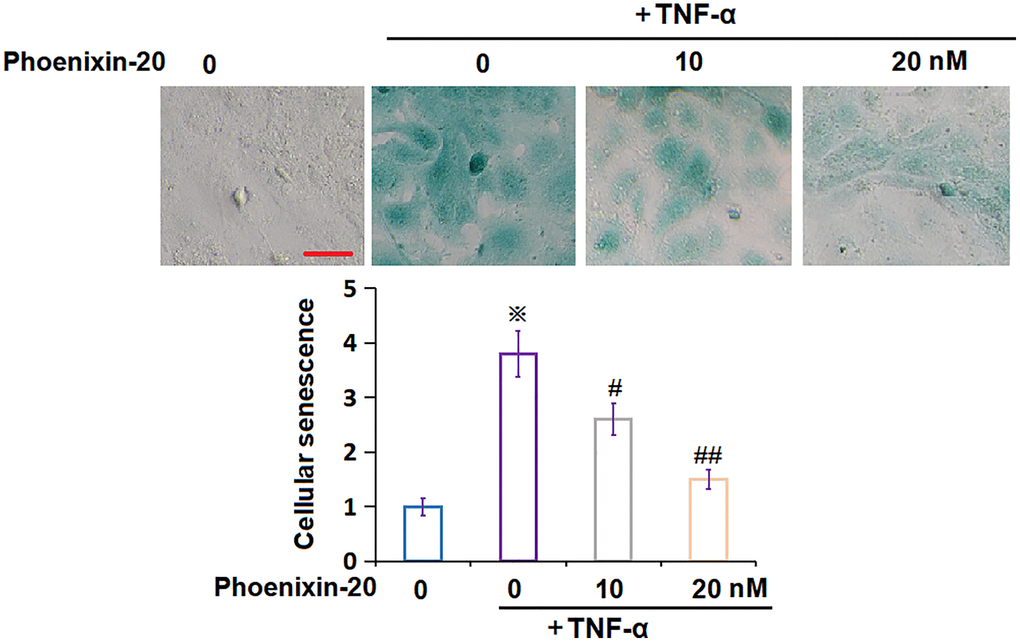 Phoenixin-20 ameliorated TNF-α-induced cellular senescence in RA-FLSs. RA-FLSs were stimulated with TNF-α (10 ng/mL) with or without Phoenixin-20 (10, 20 nM) for 7 days. Cellular senescence was assayed using SA-β-gal staining. Scale bar, 100 μm (※P #, ##, P N = 6).