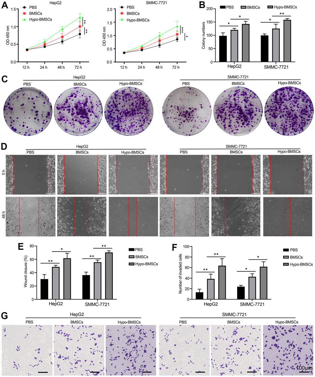 Hypoxic BMSCs co-culture promotes HCC cells proliferation and metastasis in vitro. (A) Proliferation of HepG2 and SMMC-7721 cells determined by CCK-8 after co-culturing with BMSCs or hypo-BMSCs, Data were presented as the mean ± SD, and analyzed with Student’s t-test. *P B) The numbers of colony were counted from six fields of view in each group. Data were presented as the mean ± SD, and analyzed with Student’s t-test. *P C) Colony formation assays showed that the proliferation rate was increased in HepG2 and SMMC-7721 cells after co-culturing with BMSCs or hypo-BMSCs. (D) Cell migration was measured by wound healing assay. The increased migration capability induced by hypoxic BMSC-secreted exosomes. (E) The distance of migration was measured from six fields of view in each group. Data were presented as the mean ± SD, and analyzed with Student’s t-test. *P F) The numbers of dot violet were counted from six fields of view in each group. Data were presented as the mean ± SD, and analyzed with Student’s t-test. *P G) Cell invasion were measured by transwell assays. HepG2 and SMMC-7721 cells co-culturing with BMSCs or hypo-BMSCs for 48 h. Cells that invaded to the bottom surface were stained with crystal violet and observed by light microscopy (magnification, 10×).