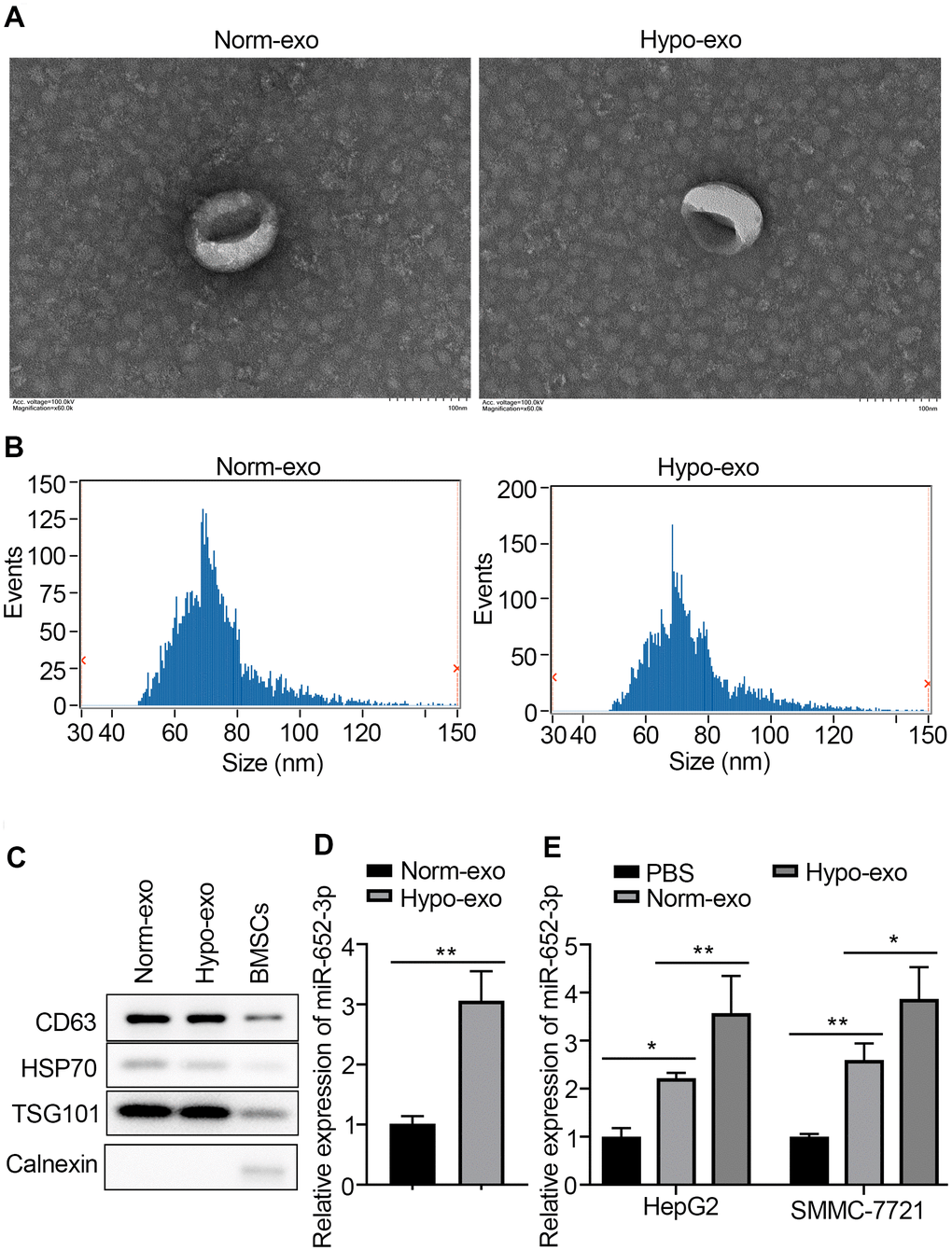 MiR-652-3p is upregulated in hyoxic BMSCs-derived exosome and can be transferred to HCC cells. (A) Transmission electron microscopy (TMB) showed the representative image of BMSCs or hypo-BMSCs derived exosome. (B) The particle diameter of the purified exosomes was showed in histogram. (C) Exosomal markers were detected by West blotting in BMSCs derived exosome and BMSCs cells. (D) Expression of miR-652-3p was detected in exosome derived from BMSCs under different conditions using qRT-PCR. Data were presented as the mean ± SD, and analyzed with Student’s t-test; ** P E) Expression of miR-652-3p was detected in HepG2 and SMMC-7721 cells after co-culturing with exosome derived from BMSCs under different conditions. Data were presented as the mean ± SD, and analyzed with Student’s t-test. *P 