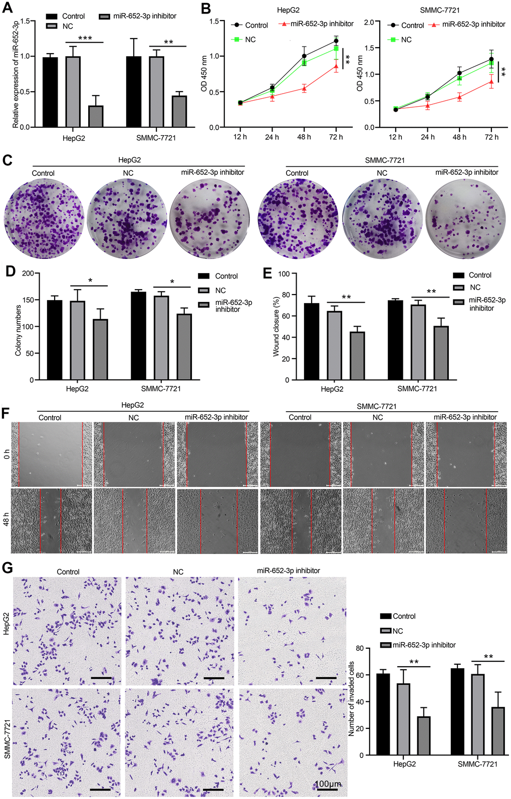 Inhibit miR-652-3p attenuates the proliferation and metastasis of HCC cells after co-culturing with BMSCs. (A) Expression of miR-652-3p was detected in HepG2 and SMMC-7721 cells co-culturing with BMSCs or hypo-BMSCs by using qPCR assay. Data were presented as the mean ± SD, and analyzed with Student’s t-test. **P B) Cell growth curves in HepG2 and SMMC-7721 cells transfected with different combinations. Data were presented as the mean ± SD, and analyzed with Student’s t-test. *P C) Colony formation assays showed that the proliferation rate was decreased in HepG2 and SMMC-7721 cells after treat isolated exosome hypo-BMSCs-derived with miR-652-3p inhibitor. (D) The numbers of colony were counted from six fields of view in each group. Data were presented as the mean ± SD, and analyzed with Student’s t-test. *P E) The distance of migration was measured from six fields of view in each group. Data were presented as the mean ± SD, and analyzed with Student’s t-test. *P F) The numbers of dot violet were counted from six fields of view in each group. Data were presented as the mean ± SD, and analyzed with Student’s t-test. *P G) Cell invasion were measured by transwell assays. HepG2 and SMMC-7721 cells co-culturing with isolated exosome hypo-BMSCs-derived with miR-652-3p inhibitor treat for 48 h. Cells that invaded to the bottom surface were stained with crystal violet and observed by light microscopy (magnification, 100×).
