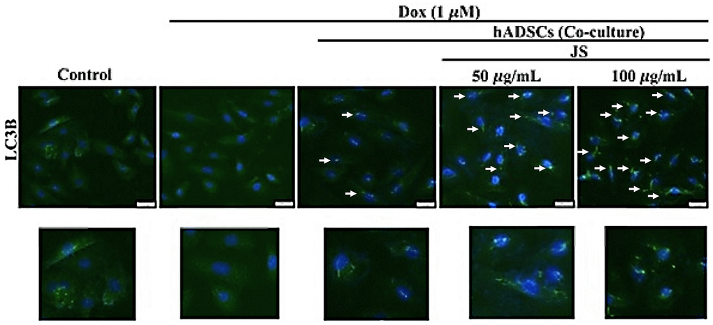 Jing Shi-preconditioned human adipose-derived stem cells (hADSCs) enhanced autophagy of doxorubicin-challenged H9c2 cells. The essential autophagic marker LC3B expression in Dox-challenged H9c2 cells was also exhibited lower expression. However, co-culture with hADSCs preconditioned with 50 or 100 μg/mL JS significantly induced the upregulated expression of LC3B in H9c2 cells. Scale bar was 100 μm.