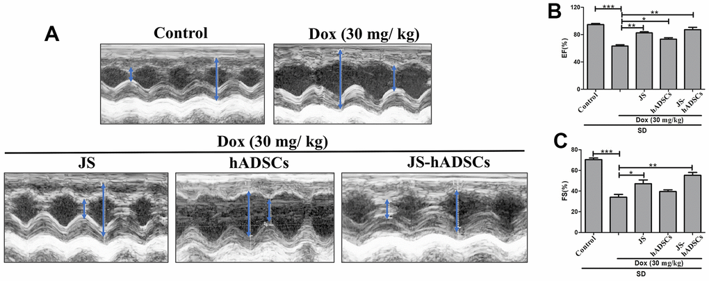 Role of Jing Shi and Jing Shi-preconditioned human adipose-derived stem cells (hADSCs) on cardiac function in doxorubicin-challenged Sprague–Dawley rats. (A) M-mode echocardiography results showing contractility functions (i.e., left ventricular internal diameter end diastole and end systole. (LVIDd and LVIDs)) of all rat groups, indicated by the blue arrow. Doxorubicin-challenged Sprague–Dawley rats treated with Jing Shi-preconditioned human adipose-derived stem cells (hADSCs) showed similar patterns to that of the control group. (B, C) The ejection fraction (EF%) and fractional shortening (FS%) of control, doxorubicin, and various treatment groups. Jing Shi-preconditioned hADSCs showed an improved repair of heart function in Doxorubicin-challenged Sprague–Dawley rats. Experiments were performed in triplicate. Data are presented as means are represented as means ± SEM. *p 