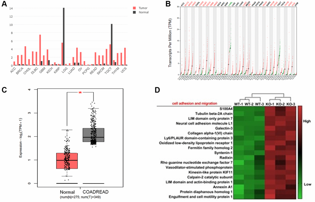 The expression of KIF18A in colorectal cancer tissues. (A, B) The transcriptional level (FPKM value) of KIF18A in pan-cancer tissues from the TCGA database. (Abbreviations: ACC: Adrenocortical Cancer; BRCA: Breast Invasive Carcinoma (Breast Cancer); CHOL: Cholangiocarcinoma (Bile Duct Cancer); DLBC: Diffuse Large B-Cell Lymphoma; GMB: Glioblastoma Multiforme (Brain Cancer); KICH: Kidney Chromophobe; KIRP: Kidney Renal Papillary Cell Carcinoma; LGG: Lower Grade Glioma; LUAD: Lung Adenocarcinoma; OV: Ovarian Serous Cystadenocarcinoma (Ovarian Cancer); PCPG: Pheochromocytoma and Paraganglioma; READ: Rectum Adenocarcinoma; SKCM: Skin Cutaneous Melanoma; TGCT: Testicular Germ Cell Tumors; THYM: Thymoma; UCS: Uterine Carcinosarcoma)). (C) The transcriptional level (FPKM value) of KIF18A in CRC and normal samples from the TCGA database. (COADREAD: Colon and Rectal Cancer). (D) The heatmap of genes involved in the cell adhesion and migration in shKIF18A-SW480 cells.