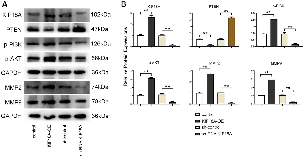 Influence of KIF18A on PTEN and PI3K/Akt signaling pathway. (A) Protein band diagrams of KIF18A, PTEN, p-PI3K, p-Akt, MMP2 and MMP9 in sh-control group, sh-RNA KIF18A group, control group, KIF18A-OE group. (B) Relative protein expressions of KIF18A, PTEN, p-PI3K, p-Akt, MMP2 and MMP9 in sh-control group, sh-RNA KIF18A group, control group, KIF18A-OE group (**p N = 3).
