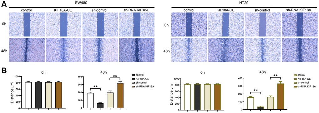 Effect of KIF18A on CRC cells migration ability. (A) Scratch wound diagrams at 0 h and 48 h in sh-control group, sh-RNA KIF18A group, control group, KIF18A-OE group. (B) Statistics of scratch-wound space at 0 h and 48 h in sh-control group, sh-RNA KIF18A group, control group, KIF18A-OE group (**p N = 3).