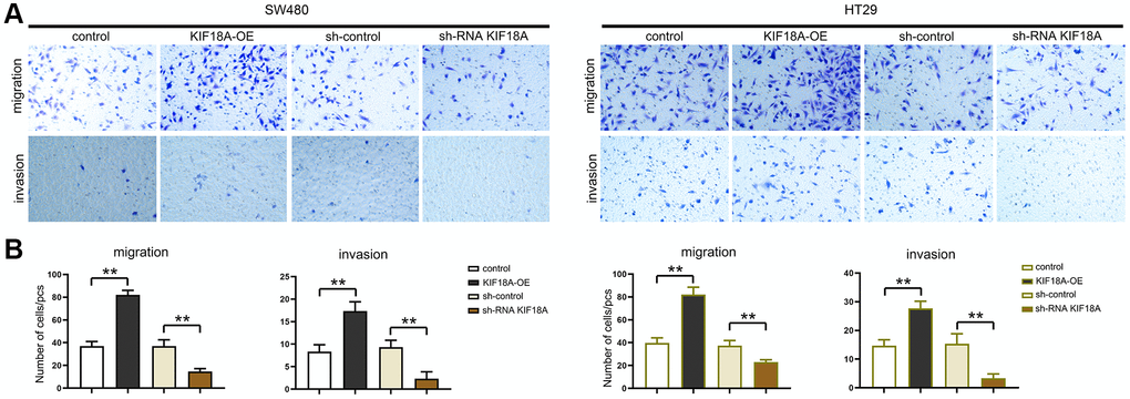 Influence of KIF18A on CRC cells migration and invasion ability. (A) Result diagrams of migration and invasion experiments in sh-control group, sh-RNA KIF18Agroup, control group, KIF18A-OE group. (B) Statistics of migration and invasion cells in sh-control group, sh-RNA KIF18A group, control group, KIF18A-OE group (**p N = 3).
