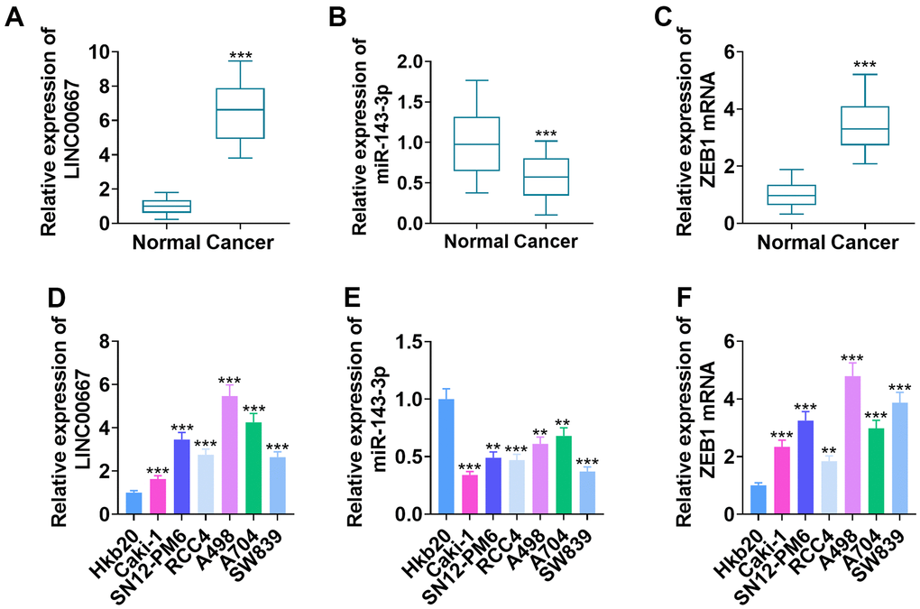 Changes in LINC00667, miR-143-3p, and ZEB1 levels in ccRCC tissues and cells. (A–C) LINC00667, miR-143-3p, and ZEB1 levels in the cancerous (N=52) and normal (N=52) tissues of ccRCC patients measured by qRT-PCR (***PD–F) LINC00667, miR-143-3p and ZEB1 levels in Hkb20, Caki-1, SN12-PM6, RCC4, A498, A704, and SW839 probed by qRT-PCR (**PP