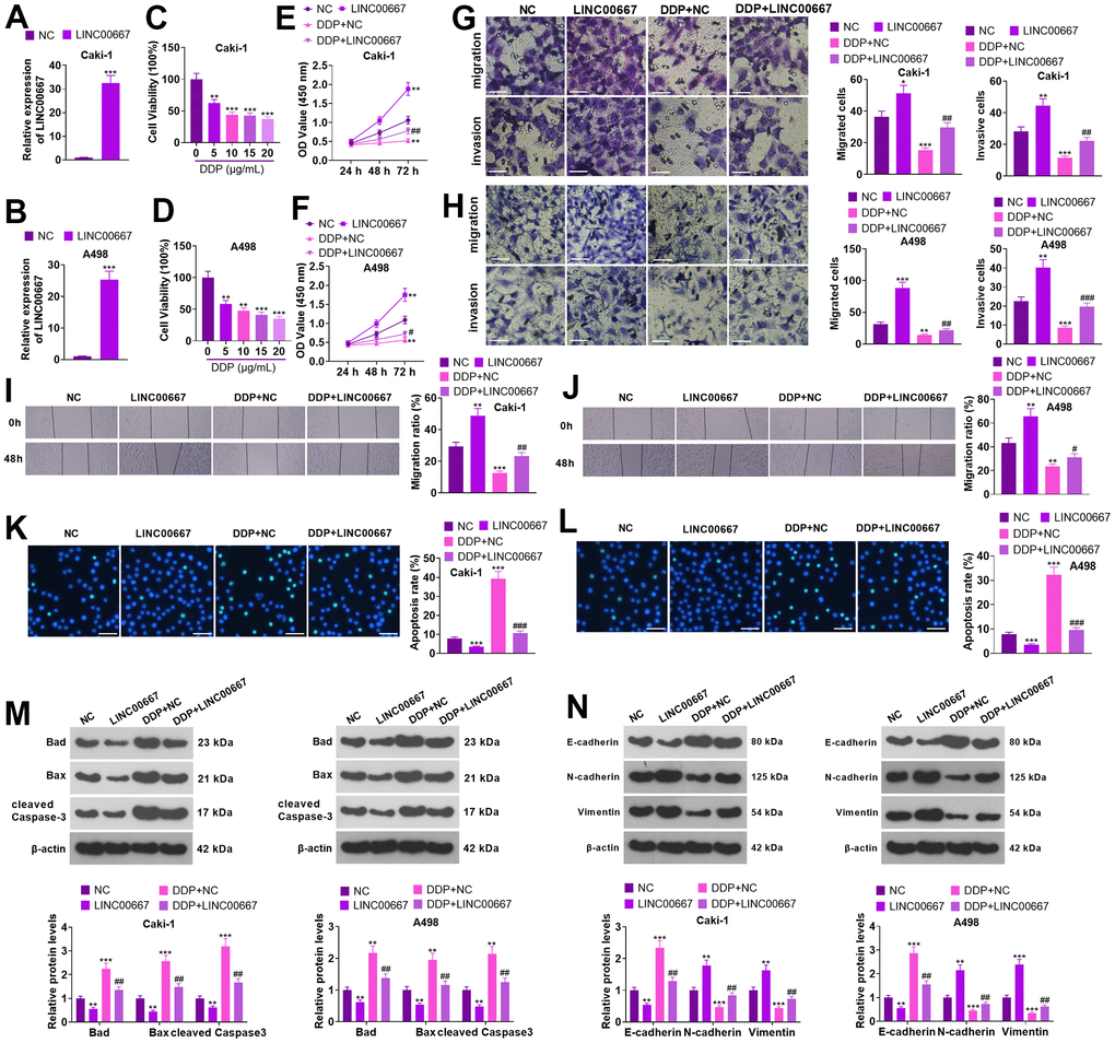 Effects of overexpression of LINC00667 on ccRCC cells. (A, B) Caki and A498 were transfected together with LINC00667 overexpression plasmids. The transfection validity of LINC00667 was checked by qRT-PCR. (C, D) DDP (0, 5, 10, 15, 20 μg/mL) treated Caki and A498 cells for 48 hours. Cell viability was measured through MTT. Caki and A498 cells transfected with LINC00667 overexpression plasmids were treated with DDP (5μg/mL) for 48 hours. (E, F) Cell viability examined through MTT. (G, H) The migration and invasion activities of the cells monitored through Transwell. Scale bar=100 μm. (I, J) Cell migration evaluated by the wound healing test. (K, L) Apoptosis gauged through TUNEL. Scale bar=50 μm. (M) Bad, Bax, and cleaved Caspase-3 levels determined via WB. (N) EMT assessed through E-cadherin, N-cadherin, and Vimentin detection. **PPPP