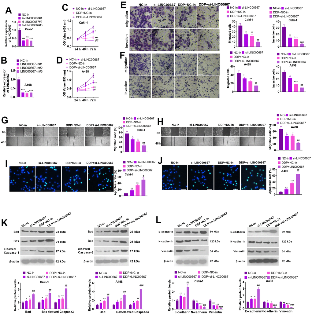 Effects of overexpression of LINC00667 on ccRCC cells. (A, B) Caki and A498 were transfected together with si-LINC00667 or NC-in. The transfection validity of LINC00667 was checked by qRT-PCR. (C, D) Cell viability was measured through MTT assay. Caki and A498 cells transfected with si-LINC00667 or NC-in, and then were treated with DDP (5μg/mL) for 48 hours. (E, F) The migration and invasion of the cells were monitored through Transwell. Scale bar=100 μm. (G, H) Cell migration was evaluated by the wound healing test. (I, J) Apoptosis was gauged through TUNEL assay. Scale bar=50 μm. (K) Bad, Bax, and cleaved Caspase-3 levels were determined via WB. (L) EMT was assessed by determining E-cadherin, N-cadherin, and Vimentin alterations. *PPPPPP