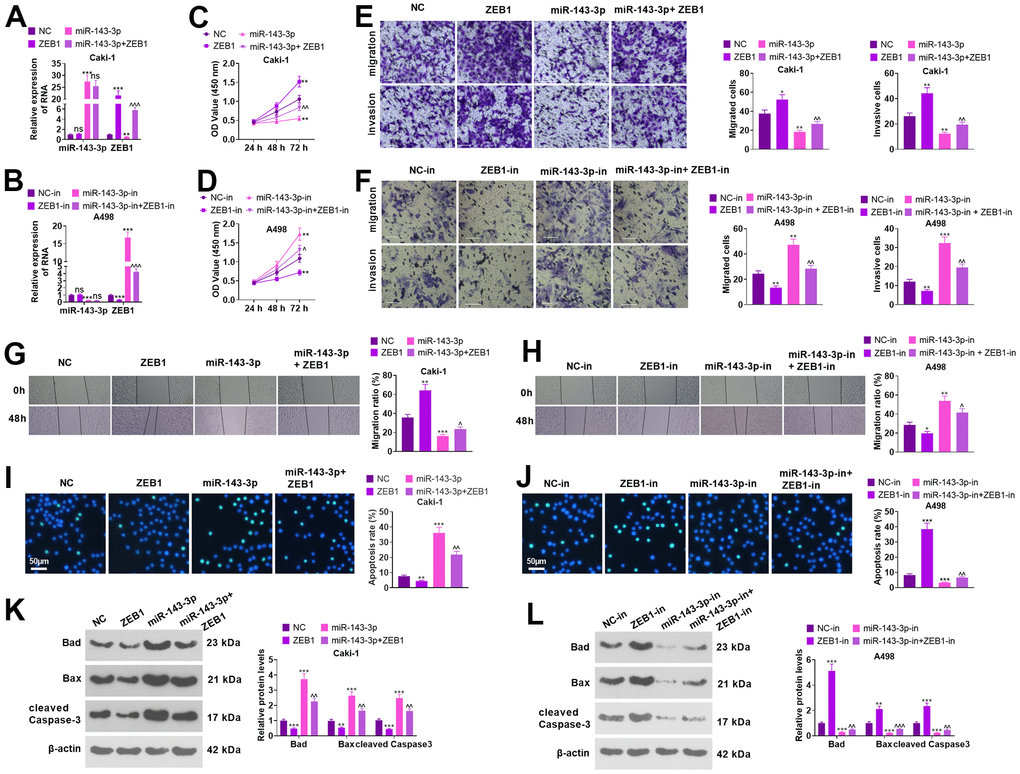 Regulation of biological functions of ccRCC cells by miR-143-3p-ZEB1 axis. Caki cells were transfected together with ZEB1 overexpression plasmids and/or miR-143-3p mimics, and A498 cells were transfected along with ZEB1-in and/or miR-143-3p-in. (A, B) miR-143-3p and ZEB1 levels in Caki and A498 cells verified by employing qRT-PCR. (C, D) Cell proliferation was examined using CCK-8. (E, F) Migration and invasion in the cells checked by Transwell. Scale bar=100 μm. (G, H) The migration of the cells was evaluated by the wound healing test. (I, J) Cell apoptosis monitored using TUNEL. Scale bar=50 μm. (K, L) The levels of apoptosis-associated proteins were compared using WB. nsP>0.05, **PPP>0.05, ^^PP